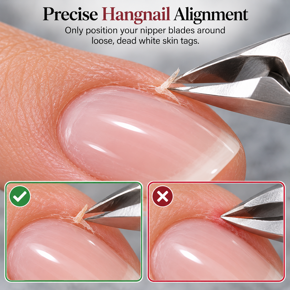 Precise Hangnail Alignment
